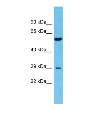 TMPRSS11E Antibody (aa35-84)