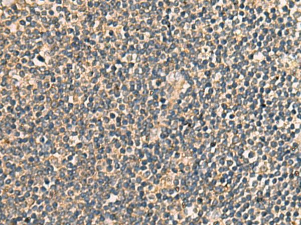 Polyclonal Rabbit anti-Human PRKRA / PACT Antibody (IHC)