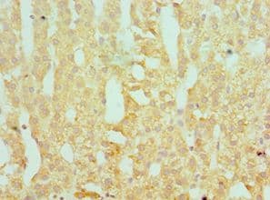 SERPINA10 / PZI Antibody (aa165-444)