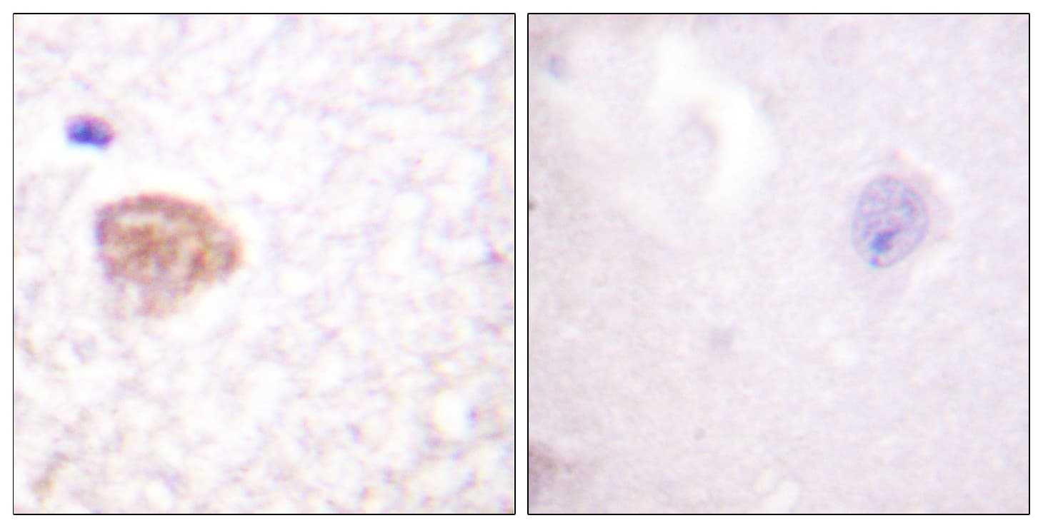 DDX3 / DDX3X Antibody (aa466-515)
