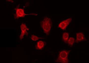 GPR137C / TM7SF1L2 Antibody