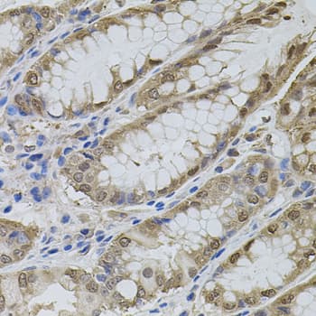 Polyclonal Rabbit anti-Human MAPK1 / ERK2 Antibody (IHC, WB)