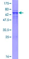 Human WDSUB1 Protein (Recombinant GST)