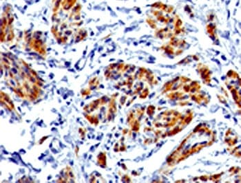 CALD1 / Caldesmon Antibody (clone RMCDN1-1)