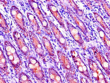 LIPG / Endothelial Lipase Antibody