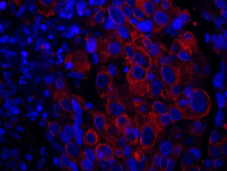 SASH1 Antibody (aa750-800)