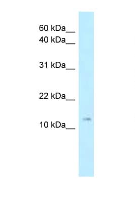 Polyclonal Rabbit anti-Mouse STMN1 / Stathmin / LAG Antibody (N-Terminus, WB)