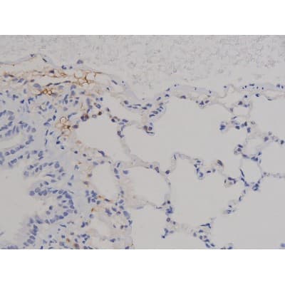 STAT6 Antibody (phospho-Thr645)
