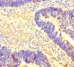 Polyclonal Rabbit anti-Human PRMT4 / CARM1 Antibody (IHC, IF, WB)