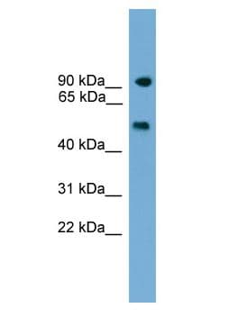 Polyclonal Rabbit anti-Human PARP8 Antibody (aa461-472, WB)