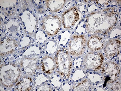 Monoclonal Mouse anti-Human ACAA1 Antibody (clone OTI4F1, IHC, WB)