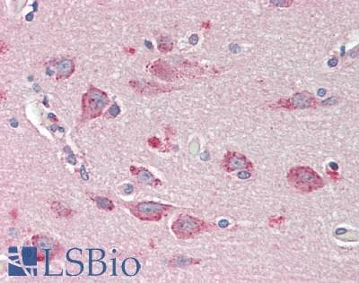 IHC-plus™ Polyclonal Goat anti-Human BMP1 Antibody (IHC, WB)