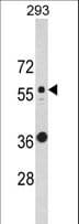 IHC-plus™ KRT10 / CK10 / Cytokeratin 10 Antibody (aa150-179)