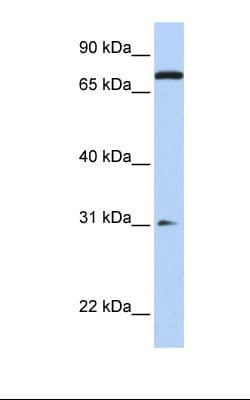 Polyclonal Rabbit anti-Human MAP4K1 / HPK1 Antibody (FITC, aa218-267, WB)