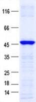 Human GLI4 Protein (Recombinant His, N-Terminal)