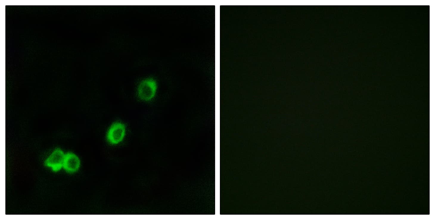 ACOT1 Antibody (aa91-140)