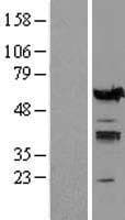 IRF5 Protein (Over-Expression Lysate Myc-DDK (Flag))