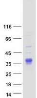 Human SFTPA2B Protein (Recombinant Myc-DDK (Flag))