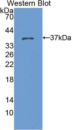 KRT15 / CK15 / Cytokeratin 15 Antibody (aa94-402)