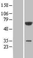 PGM3 Protein (Over-Expression Lysate Myc-DDK (Flag))