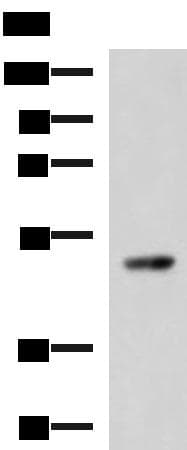 Polyclonal Rabbit anti-Human TP53 / p53 Antibody (WB)