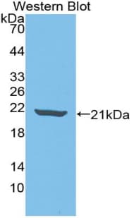 IL18BP Antibody (aa31-194)