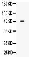 IL12RB1 / CD212 Antibody