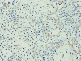 APOL1 / Apolipoprotein L Antibody (aa179-398)