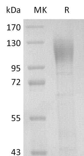 Coronavirus SARS-CoV-2 S1 Protein (Recombinant 6His, C-terminus)