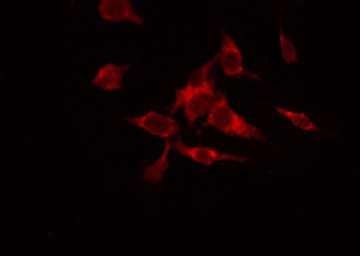 Polyclonal Rabbit anti-Human SENP7 Antibody (IHC, IF, WB)