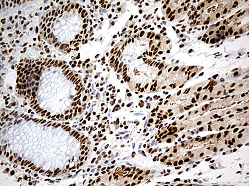 Monoclonal Mouse anti-Human DDX39B / UAP56 Antibody (clone OTI7H4, Carrier-free, aa319-428, IHC, WB)