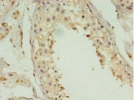 ACBD4 Antibody (aa1-305)