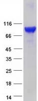 Human EPS8L1 Protein (Recombinant Myc-DDK (Flag))