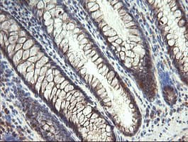 MMACHC Antibody (clone OTI1A4)