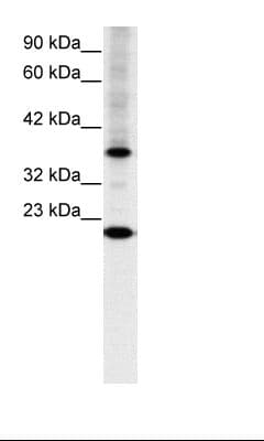 CRTR1 / TFCP2L1 Antibody (aa20-69)