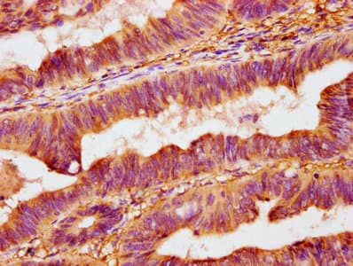 OMD / Osteomodulin Antibody