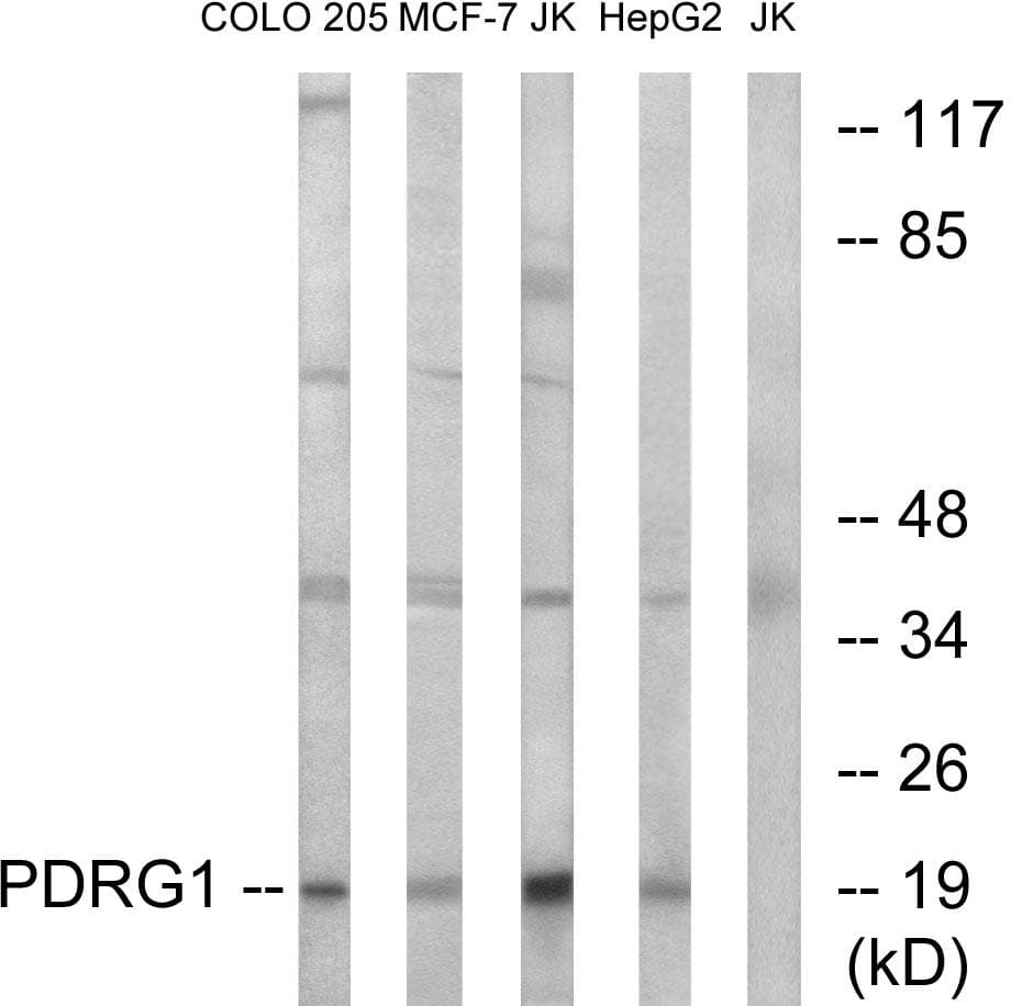 Polyclonal Rabbit anti-Human PDRG1 Antibody (WB)