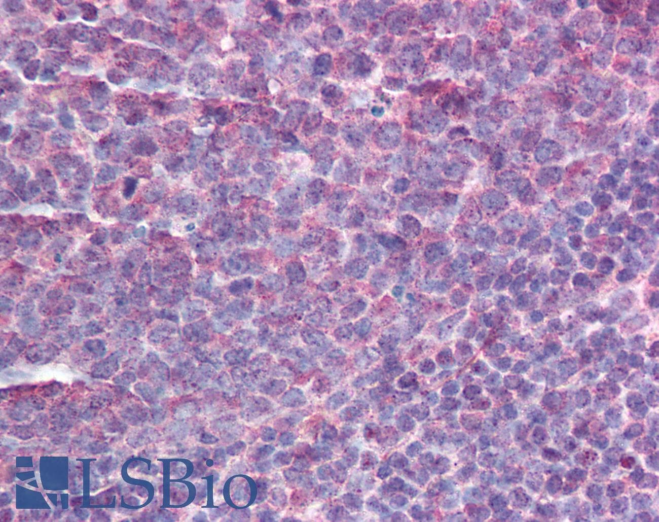 IHC-plus™ AICDA / AID Antibody