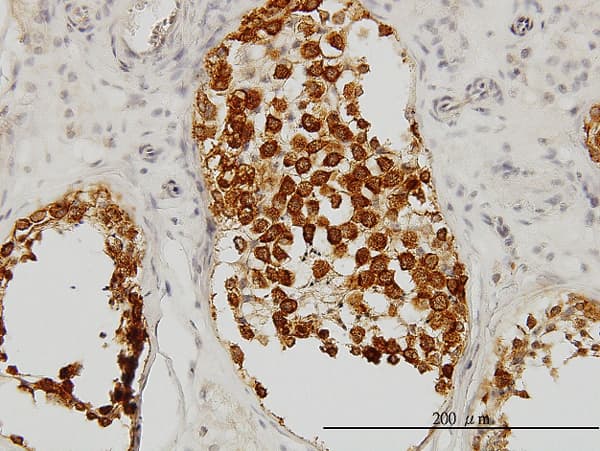 DAZ1 / DAZ Antibody (clone 3A4)
