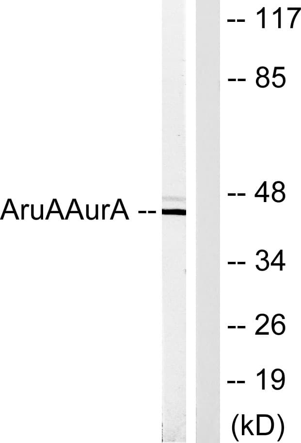 Polyclonal Rabbit anti-Human AURKA / Aurora-A Antibody (aa311-360, WB)