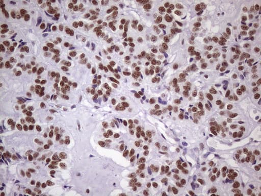 NUDT21 Antibody (aa2-227, clone OTI1B1)