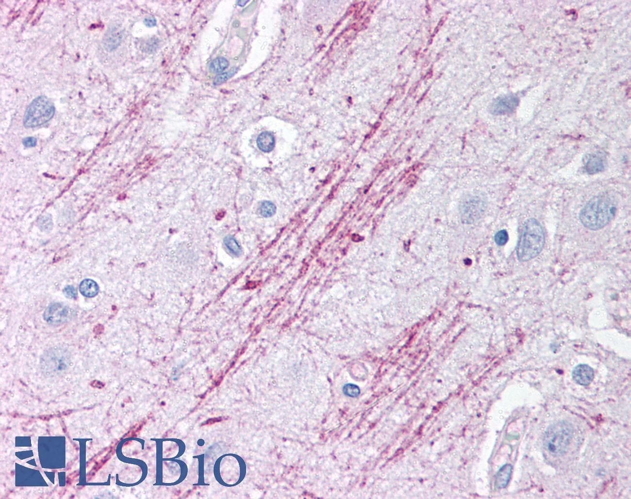 Polyclonal Rabbit anti-Human GDI2 Antibody (aa361-410, IHC, WB)
