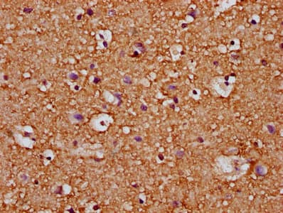 Polyclonal Rabbit anti-Human NGAP / RASAL2 Antibody (IHC, IF)