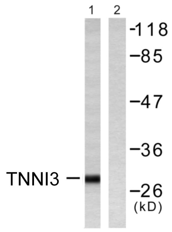 TNNI3 / Cardiac Troponin I Antibody (p22/23)