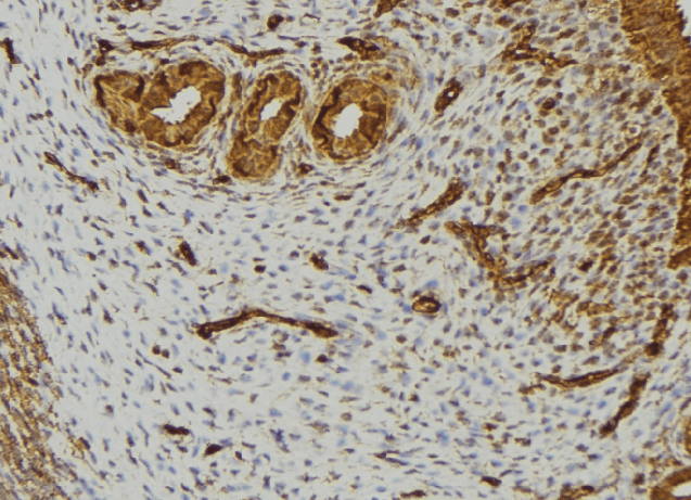 LTA / TNF Beta Antibody