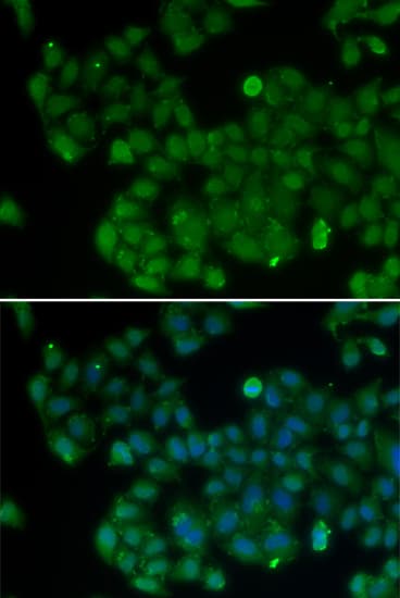 DNMT3L Antibody