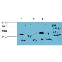 IHC-plus™ Monoclonal Mouse anti-Human MAP1LC3A / LC3A Antibody (clone 5G10, IHC, WB)