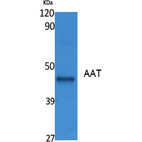 SERPINA1 / Alpha 1 Antitrypsin Antibody (240-320 aa, Internal)
