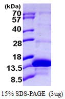 Human KAAG1 Protein (Recombinant His)