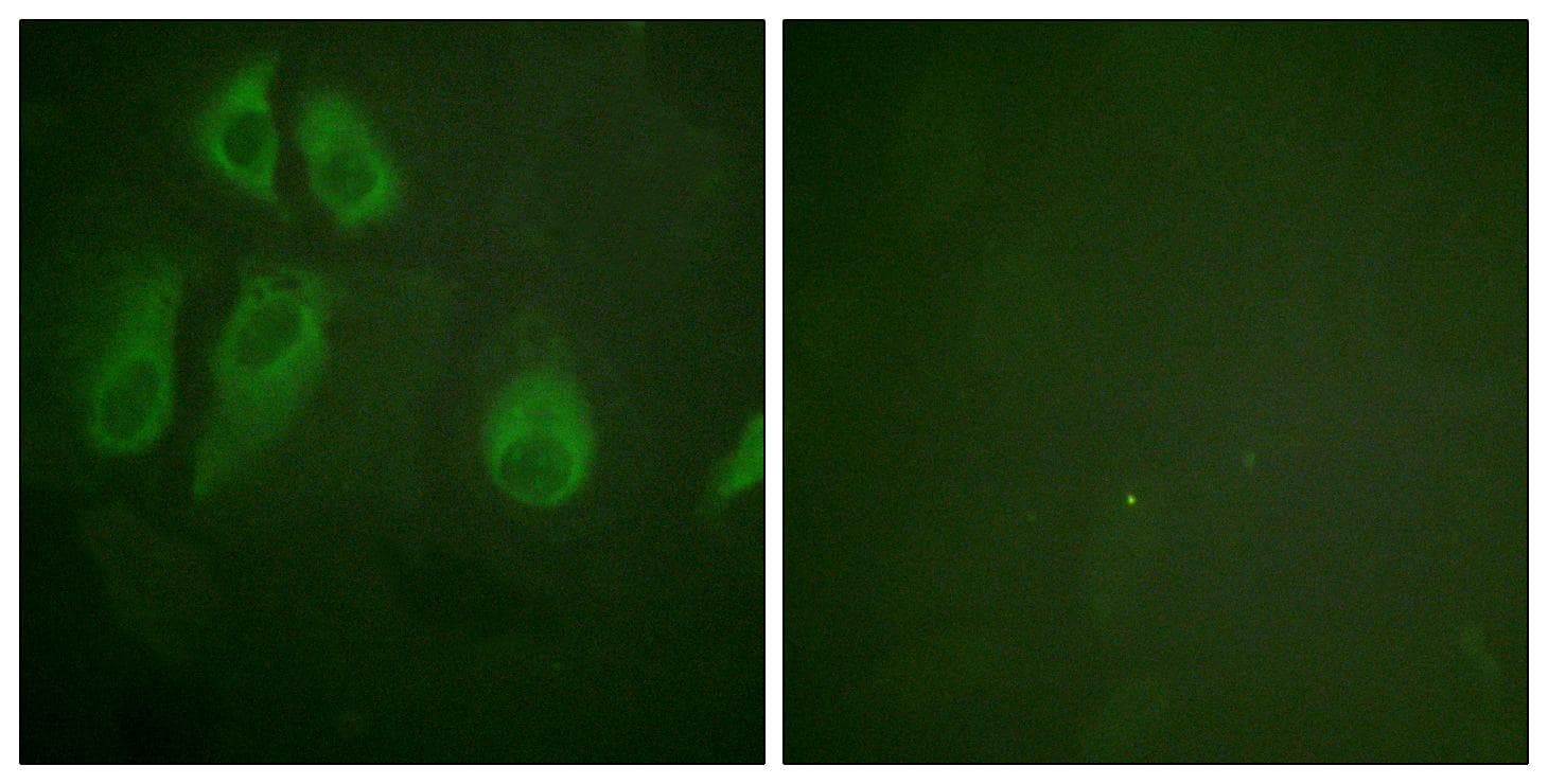 Polyclonal Rabbit anti-Human IL2RA / CD25 Antibody (p268, IF, WB)